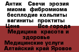 Антик.  Свечи (эрозия, миома, фибромиома, бесплодие,кольпиты, вагиниты, проктиты › Цена ­ 550 - Все города Медицина, красота и здоровье » Медицинские услуги   . Алтайский край,Яровое г.